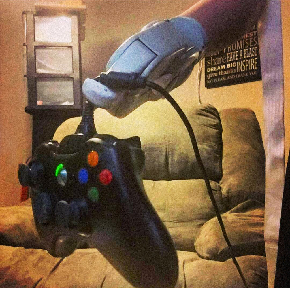 Aaron Soetaert holding an Xbox 360 controller with prosthetic arm