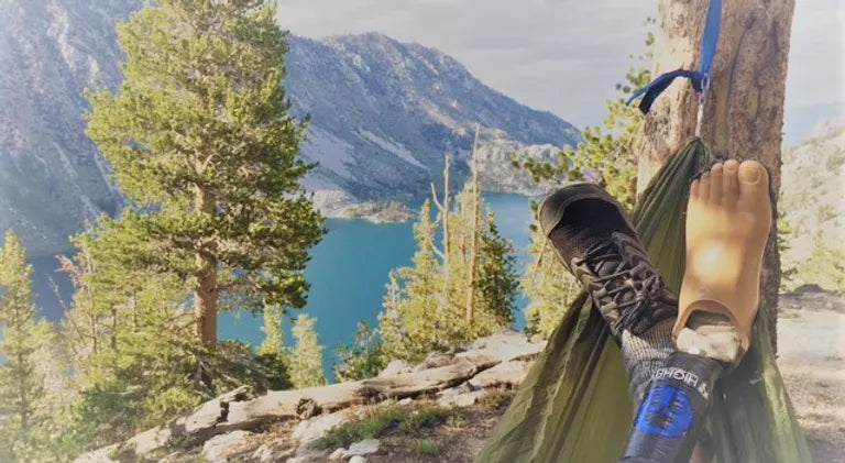 A person with prosthetics sitting on a hammock overlooking a lake